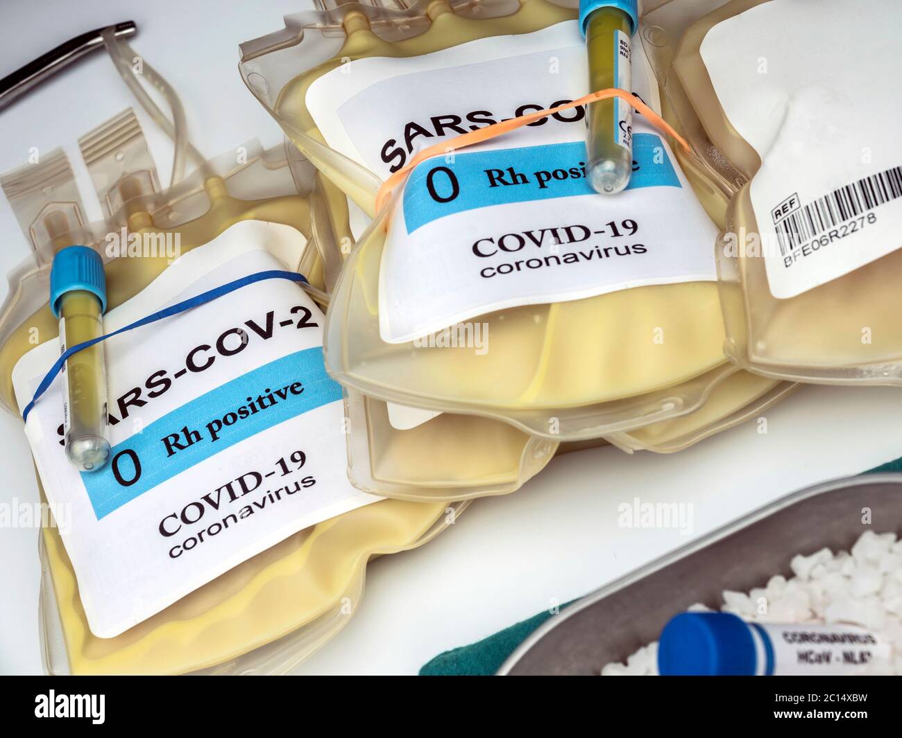 Sacca per plasma con anticorpi da persone curate di SARS-COV-2 Covid-19 preparata in un'immagine concettuale ospedaliera Foto Stock