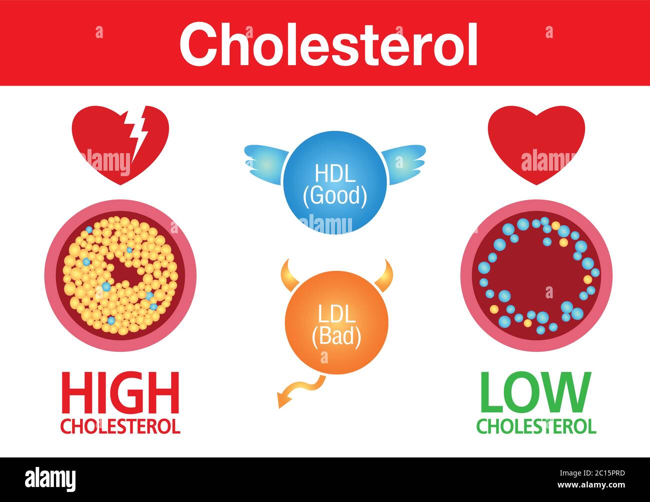 Colesterolo in arteria, rischio per la salute, esercizio, disegno vettoriale Illustrazione Vettoriale