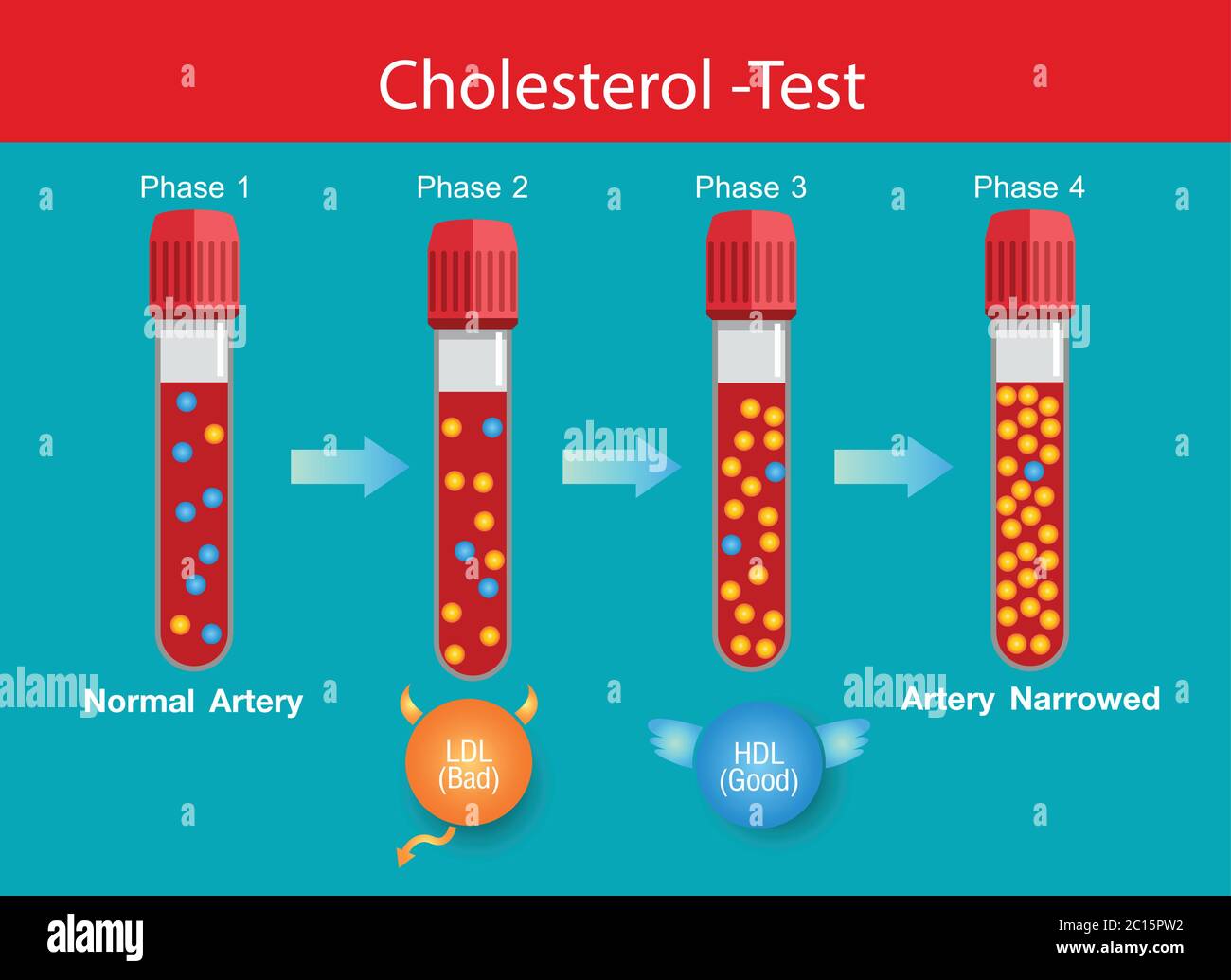 Colesterolo in arteria, rischio per la salute, livelli di colesterolo, disegno vettoriale Illustrazione Vettoriale