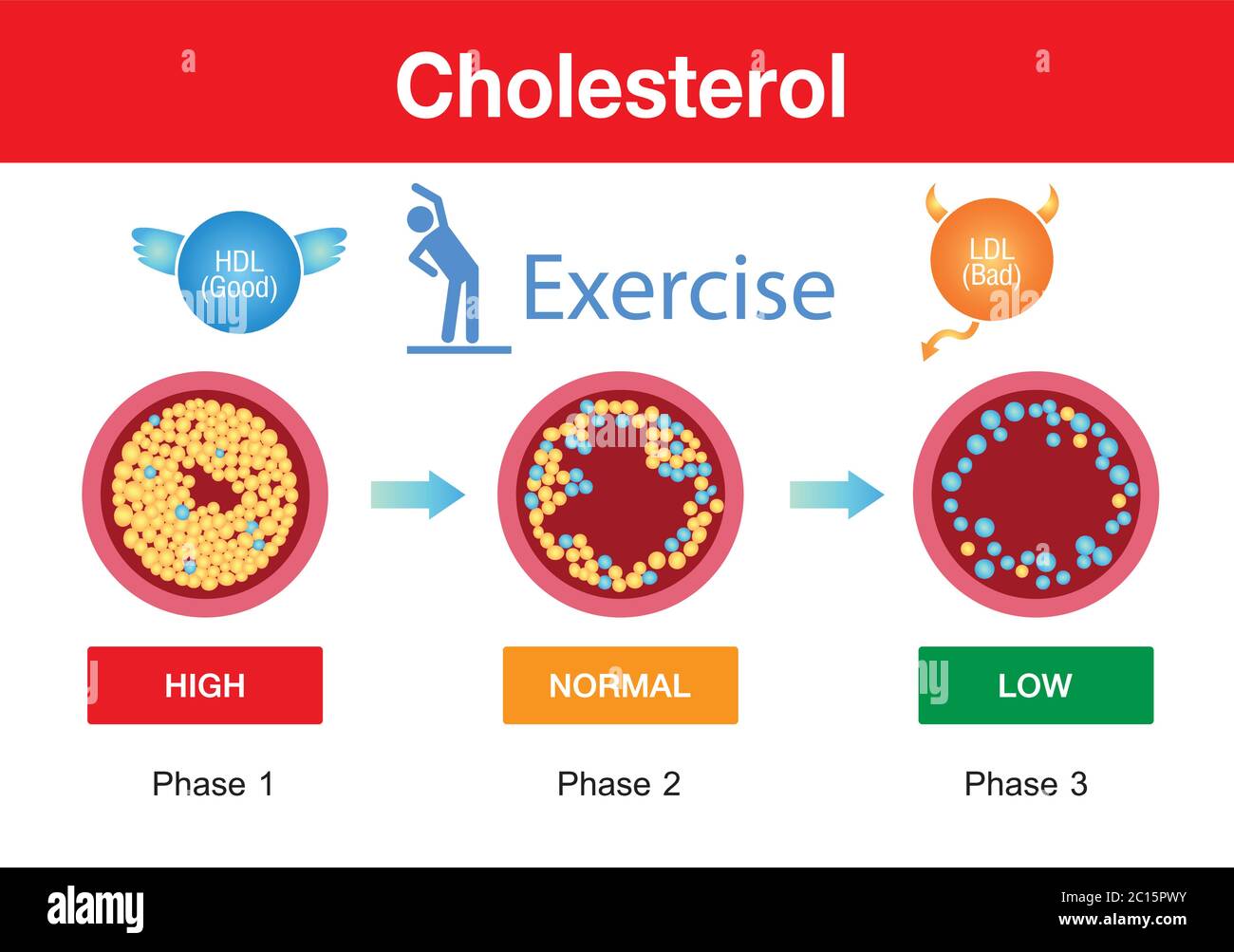 Colesterolo in arteria, rischio per la salute, esercizio, disegno vettoriale Illustrazione Vettoriale