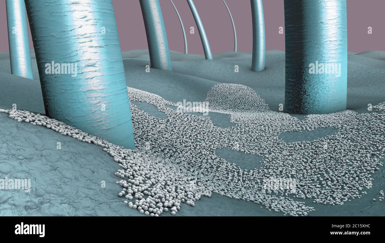 Microscopico primo piano di un'infezione fungina dello strato superiore della pelle, chiamata micosi della pelle - illustrazione 3d Foto Stock