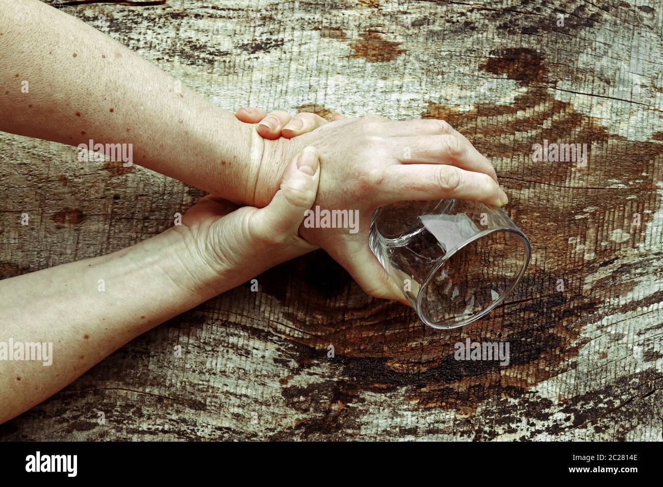 Una donna con Parkinson scuote le mani così male che non può più tenere un bicchiere. Mani tremanti di una donna anziana Foto Stock