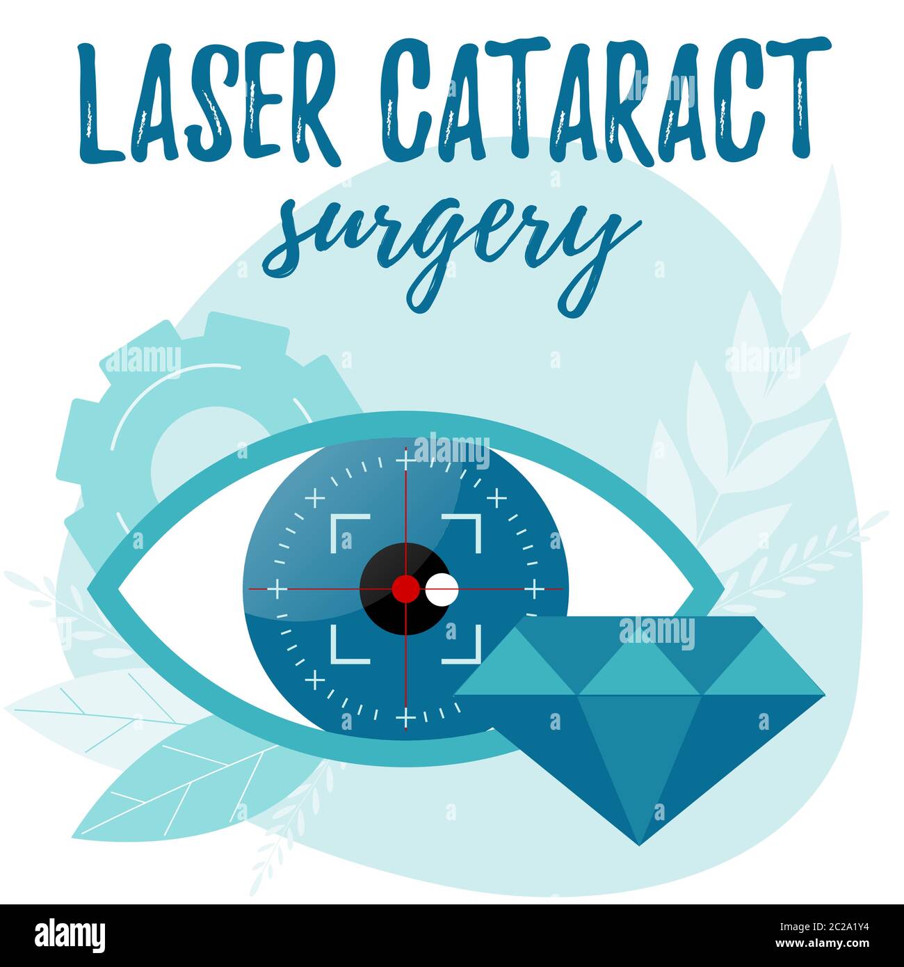 Illustrazione della chirurgia cataratta laser. Concetto di scambio di lenti rifrattive. Illustrazione Vettoriale