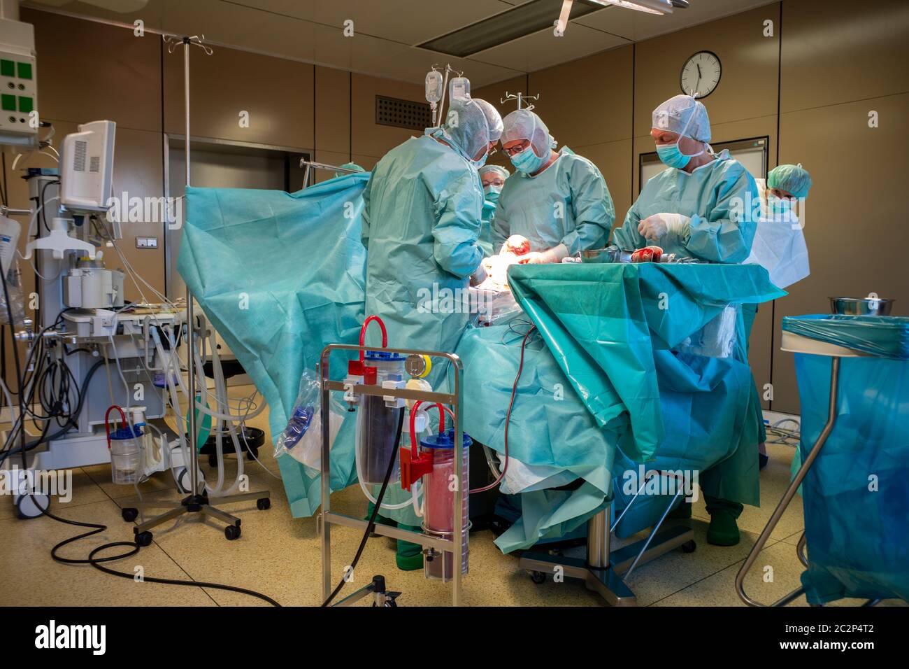 in una sala operatoria, una sezione cesarei viene eseguita da un team chirurgico Foto Stock