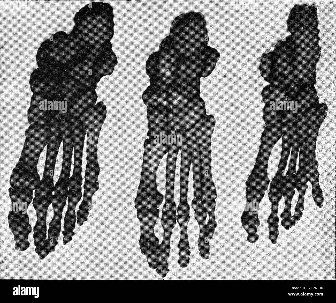 Tabella comparativa dello scheletro del piede di un'illustrazione giapponese, europea e australiana, d'epoca incisa. Dall'Universo e Humani Foto Stock