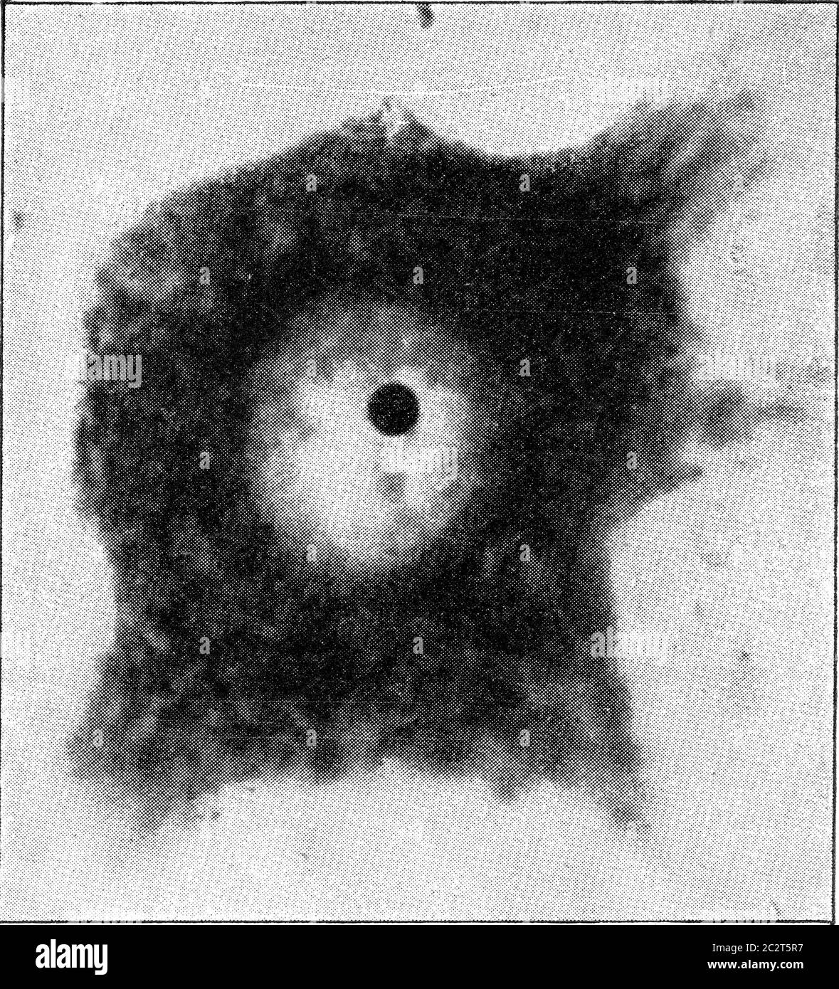 Cellula nervosa con il suo nucleo e un piccolo nucleo di corpuscolo molto fortemente ingrandito, immagine vintage incisa. Dall'Universo e dall'umanità, 1910. Foto Stock
