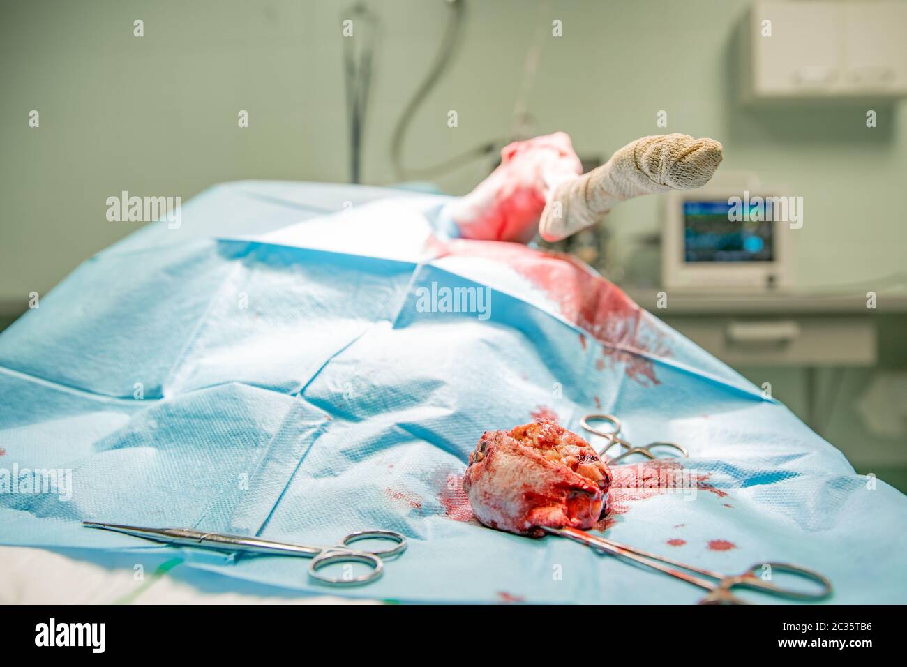 rimozione del tumore benigno sulla zampa del cane da intervento chirurgico. Foto Stock