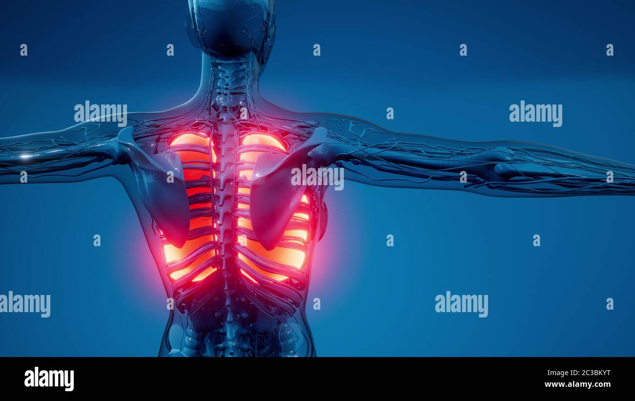 Polmoni umani esame radiologico Foto Stock