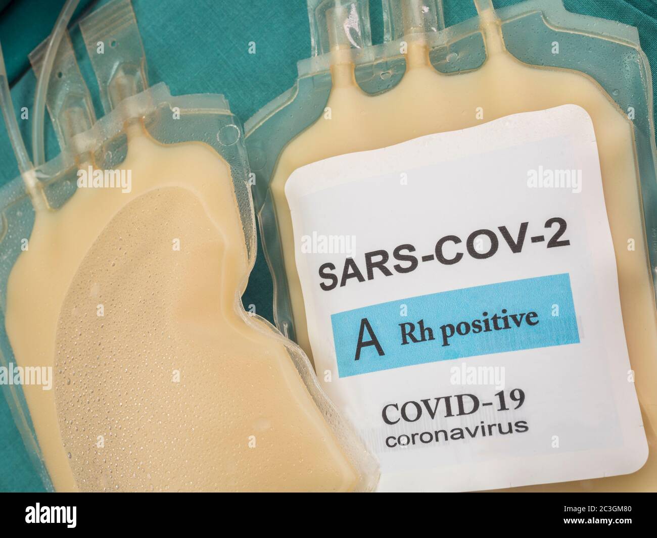 Sacca per plasma con anticorpi da persone curate di SARS-COV-2 Covid-19 preparata in un'immagine concettuale ospedaliera Foto Stock