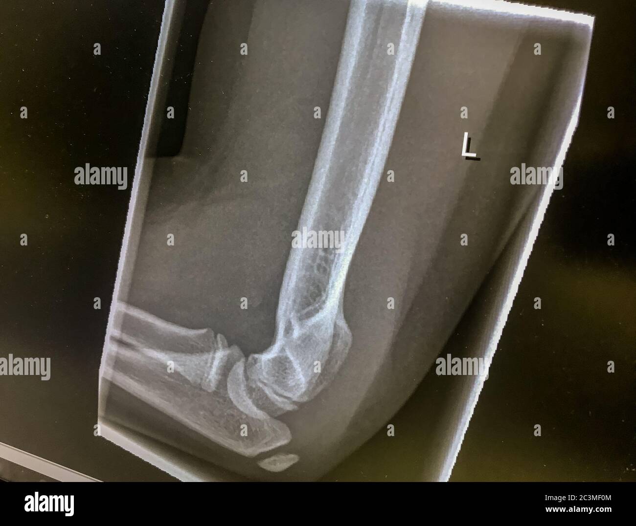 Immagine radiologica da un ortopedico Foto Stock