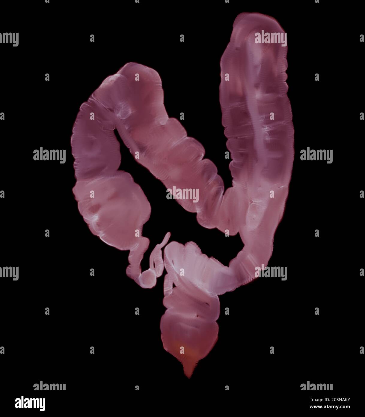 Colon o colon di grandi dimensioni in tecnica di colorazione dell'acqua che mostra il colon per lo screening del cancro colorettale. Check up Screening Colon Cancer. Foto Stock