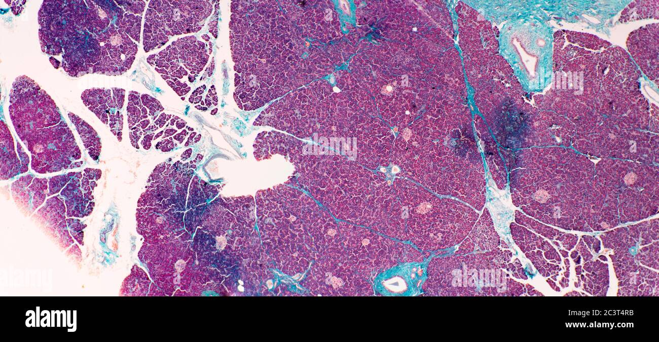 Pancreas, sezione sottile colorata, vista al microscopio Foto Stock