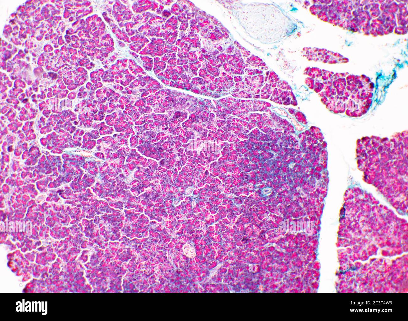 Pancreas, sezione sottile colorata, vista al microscopio Foto Stock