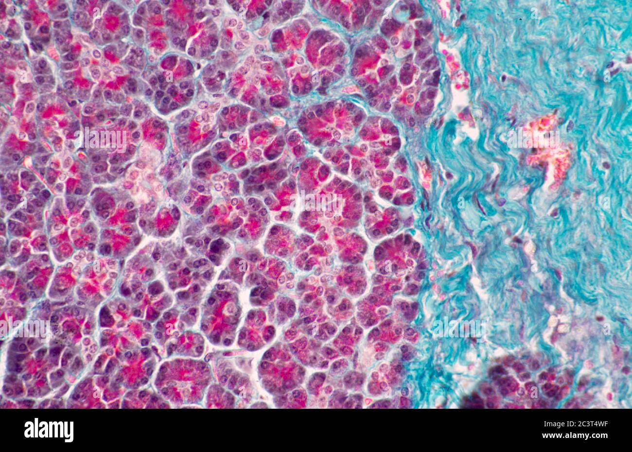 Pancreas, sezione sottile colorata, vista al microscopio Foto Stock