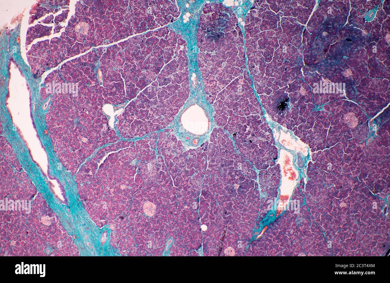 Pancreas, sezione sottile colorata, vista al microscopio Foto Stock