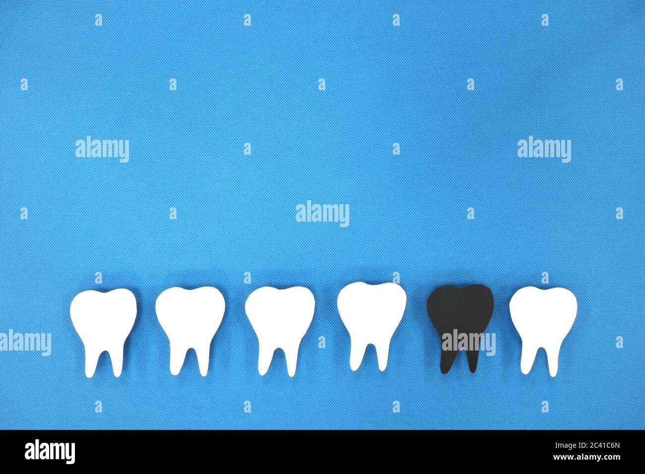 Decadimento dei denti e concetto di assistenza sanitaria dentale. Set di denti bianchi con uno nero dispari. Sfondo blu con spazio per la copia. Foto Stock