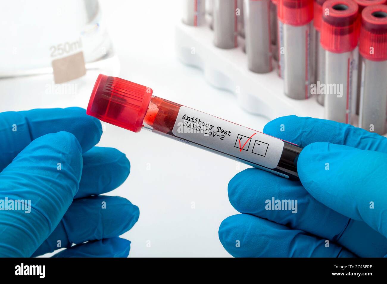 Nuovo test clinico sugli anticorpi del coronavirus e concetto diagnostico Covid-19 con Il medico che detiene il campione di plasma ematico ha utilizzato il test per l'antigene SARS-COV-2 Foto Stock