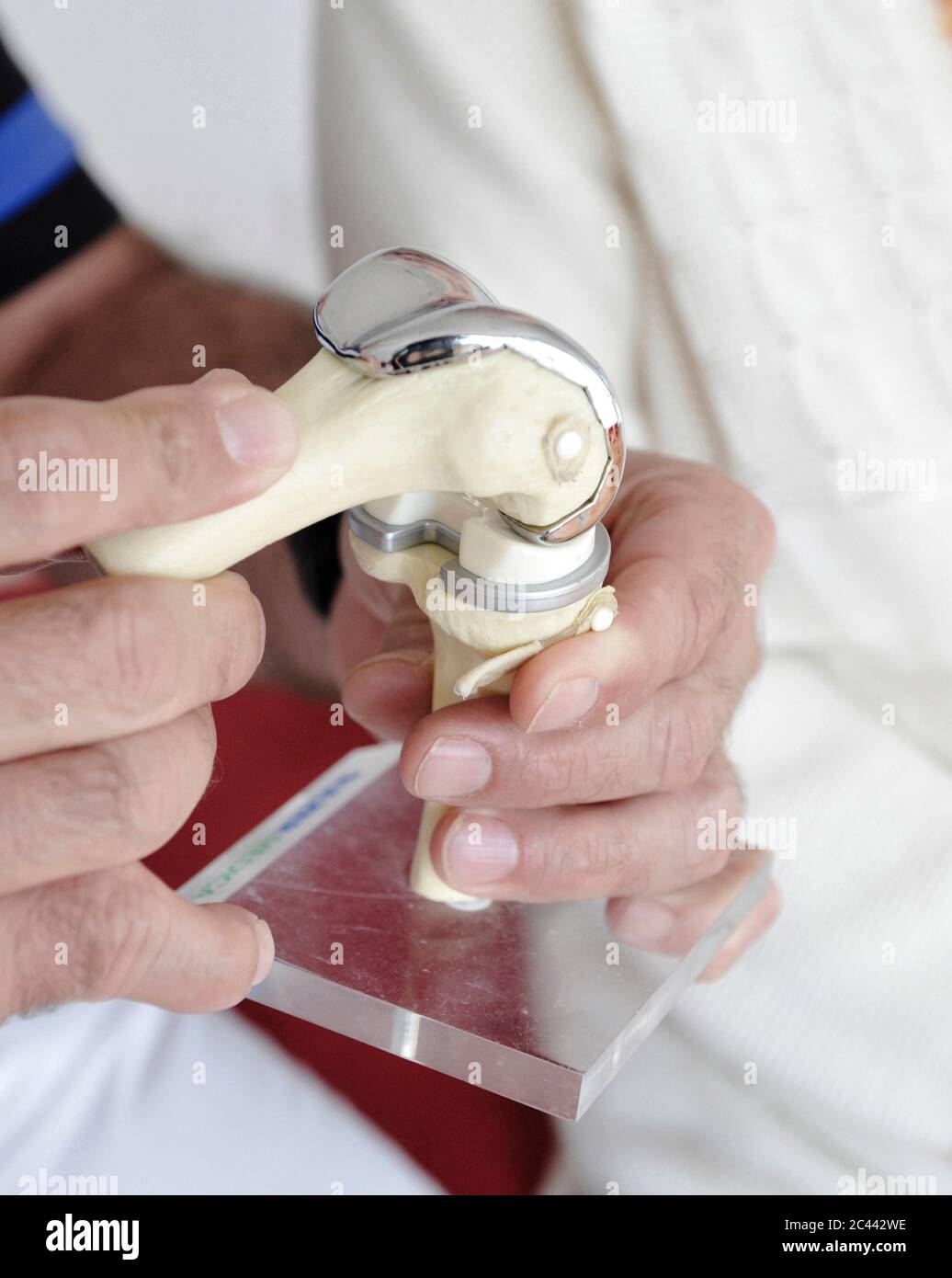 Il medico tiene il modello di un'articolazione Foto Stock