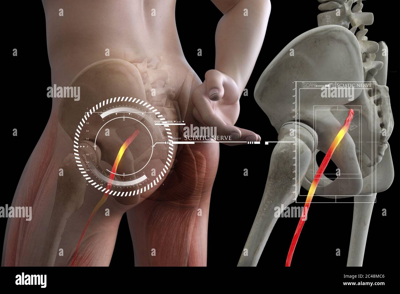 Nervo sciatico umano schiacciato, visione anatomica. illustrazione 3d. Foto Stock