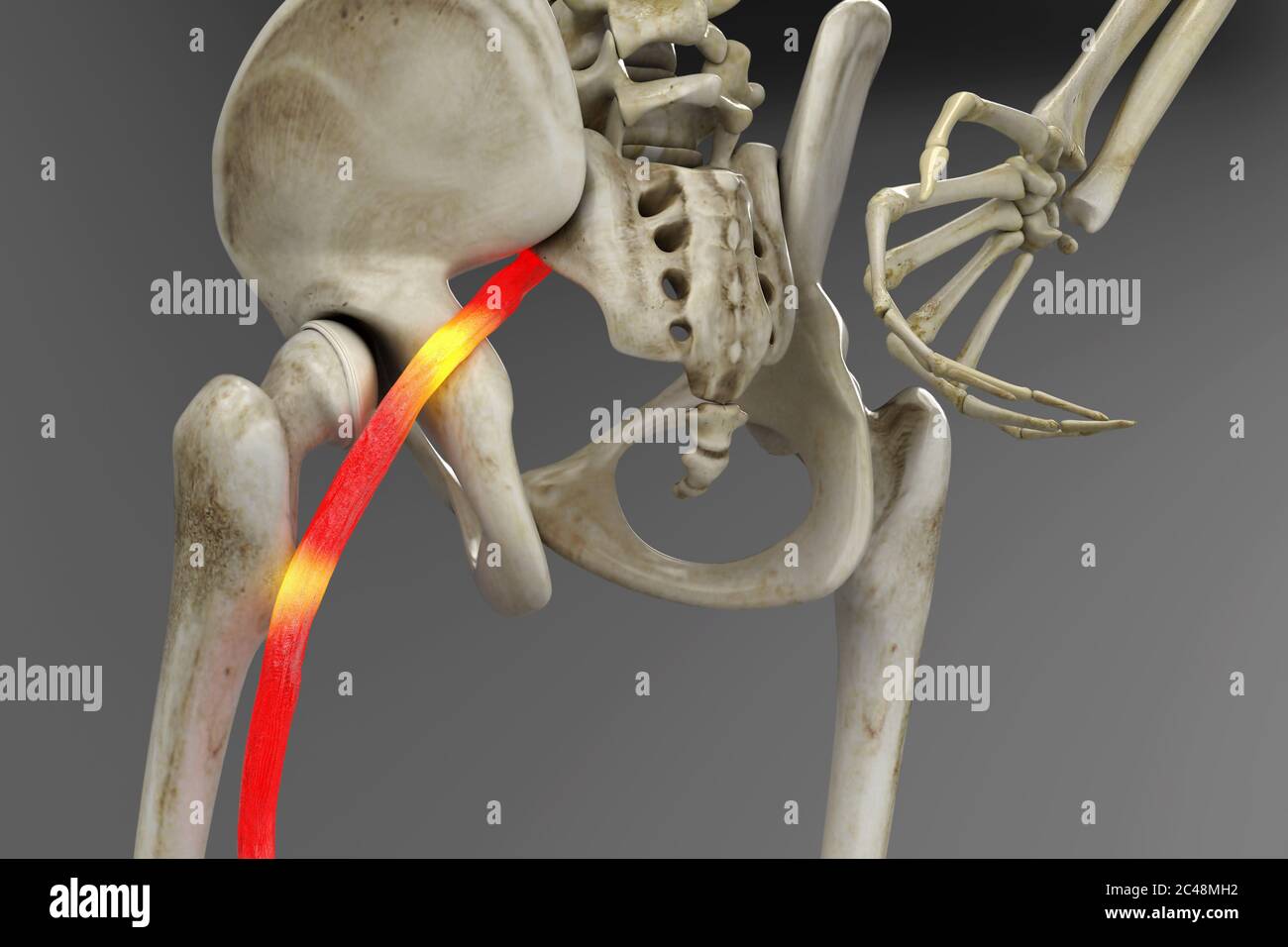 Nervo sciatico umano schiacciato, visione anatomica. illustrazione 3d. Foto Stock