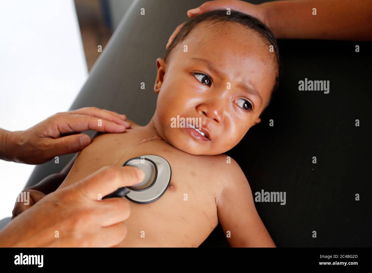 ONG francese Chaine de l'Espoir. Bambino che soffre di malattia di cuore. Consulenza medica. Antananarivo. Madagascar. Foto Stock