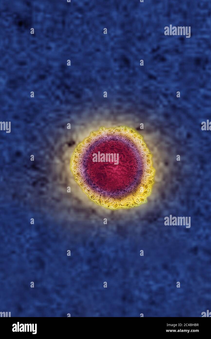 Coronavirus Foto Stock