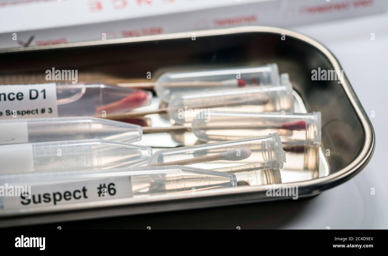 Analisi ematologica con kit di test forensi in un omicidio in un laboratorio di criminalità, immagine concettuale Foto Stock