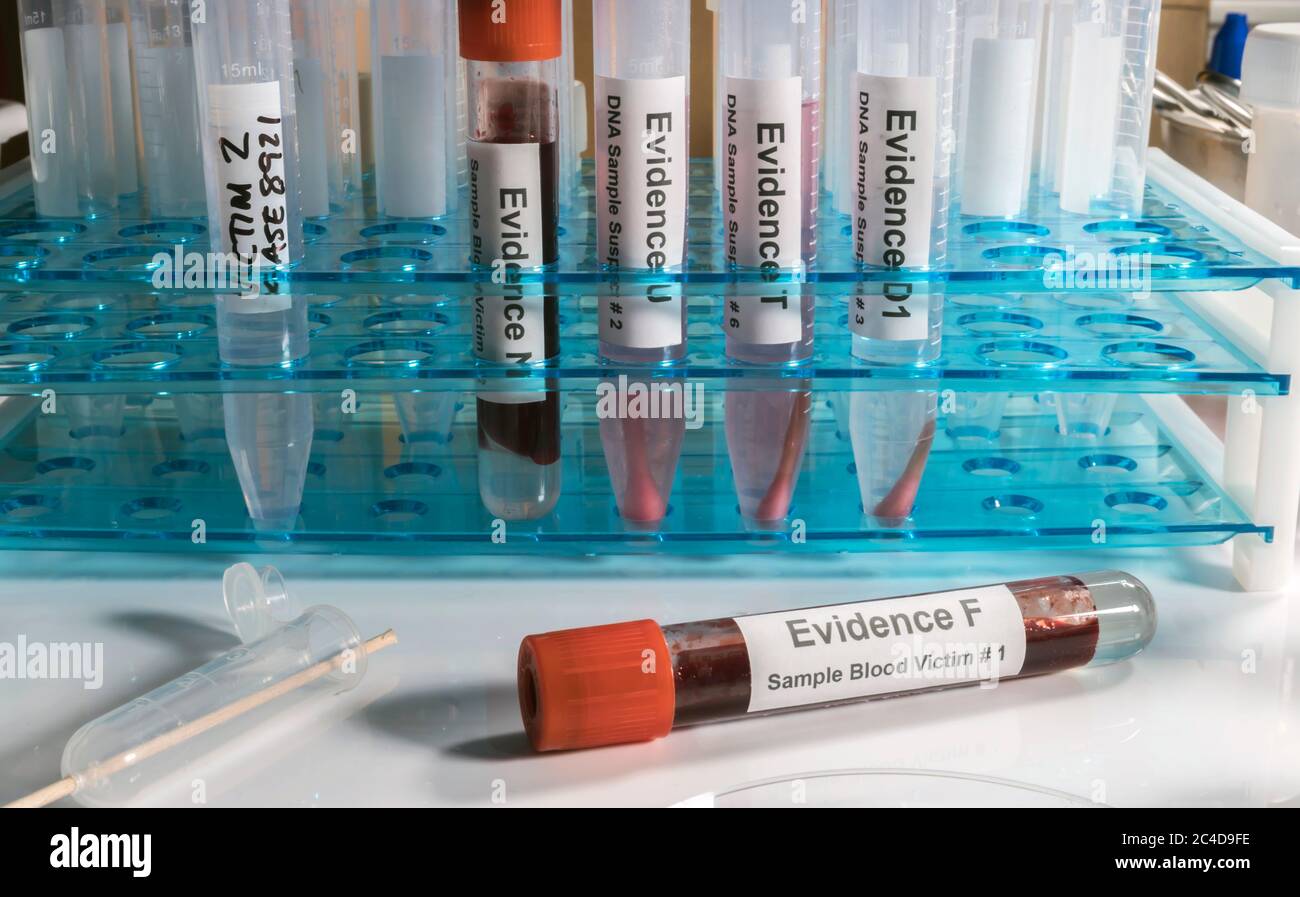Analisi ematologica con kit di test forensi in un omicidio in un laboratorio di criminalità, immagine concettuale Foto Stock
