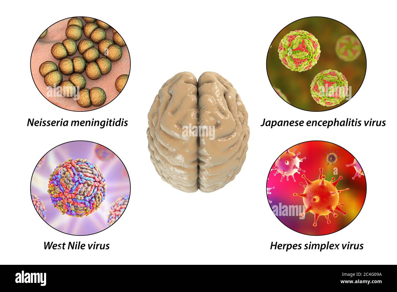 Infezioni cerebrali. Illustrazione al computer di microrganismi che causano encefalite e meningite. Immagine etichettata. Foto Stock