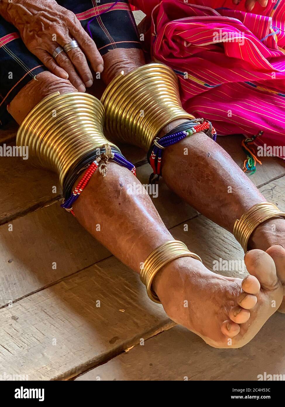 Donna seduta del Kayaw Tribe, un gruppo minoritario che vive in Myanmar indossando bobine di rame per gamba, note come 'tamburi di rana', indossate da circa 7 anni per la vita Foto Stock