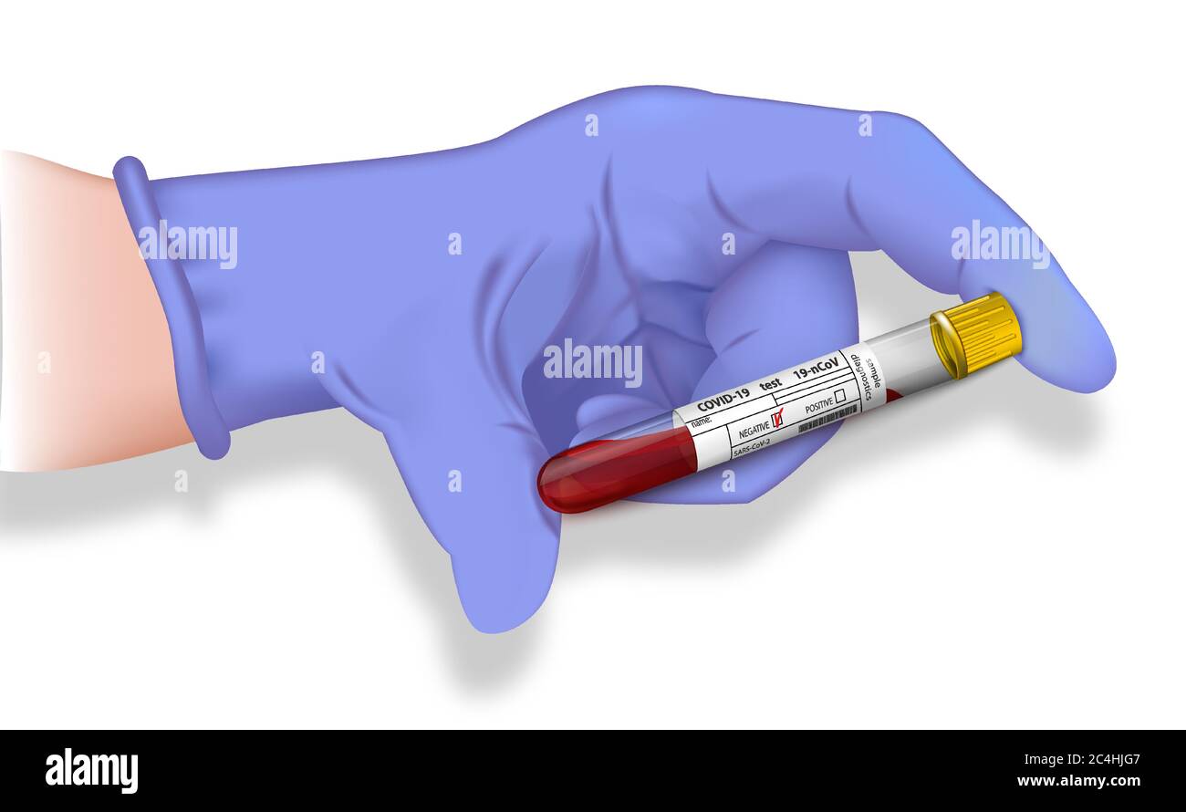 Tenere la provetta per il test del sangue con un risultato negativo sulla covid 19 in primo piano. Illustrazione vettoriale. Illustrazione Vettoriale