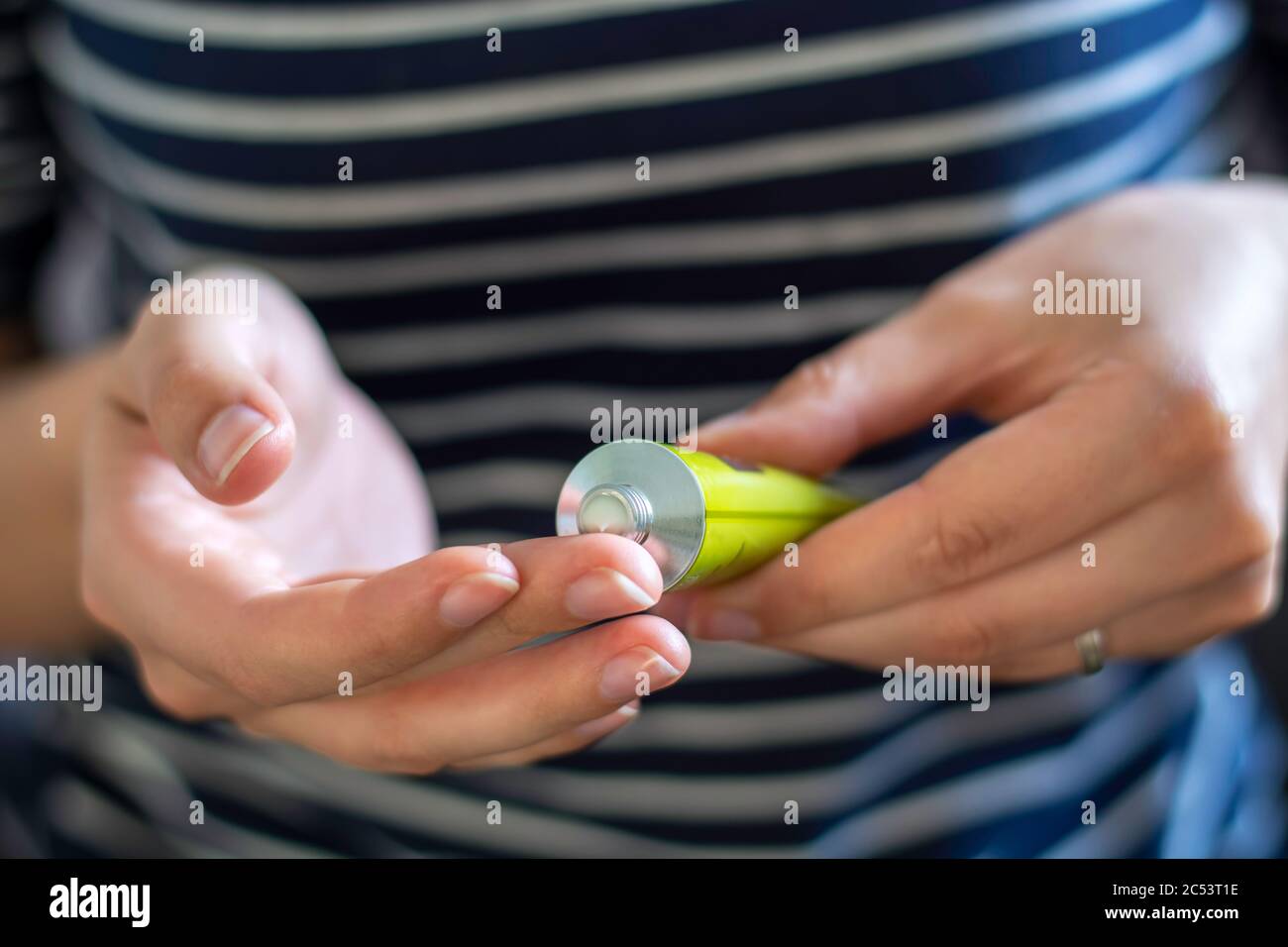 Le mani della donna usando un tubo di unguento. Applicare una crema emolliente nel trattamento e idratazione della pelle. Concetto di cura della pelle. Foto Stock