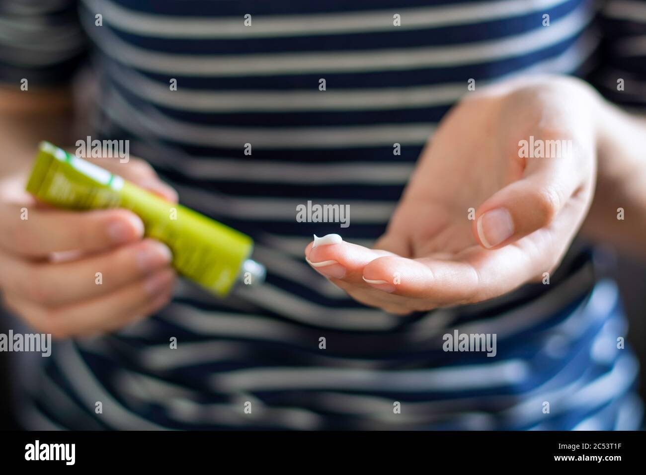 Le mani della donna usando un tubo di unguento. Applicare una crema emolliente nel trattamento e idratazione della pelle. Concetto di cura della pelle. Foto Stock