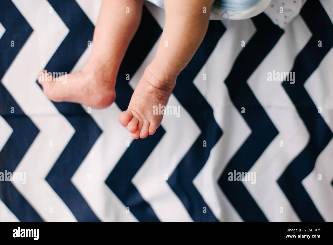 Piedi e gambe del neonato. Delicato e stropicciato. Piedi deboli e scrawny. Foto Stock
