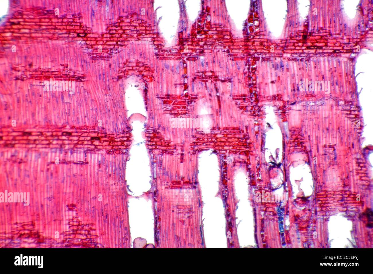 Fotomicrografia a campo chiaro, albero di Brushbox, Lophostemon confertus, dettaglio stelo Foto Stock