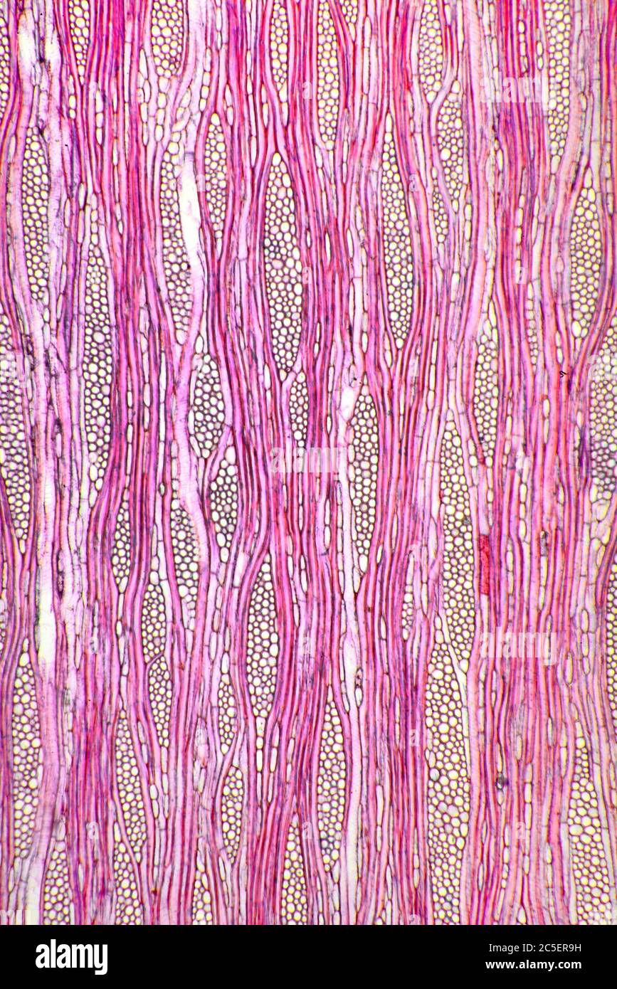 Ilex aquafolia Linn, dettaglio stelo Holly, fotomicrografia a campo chiaro Foto Stock