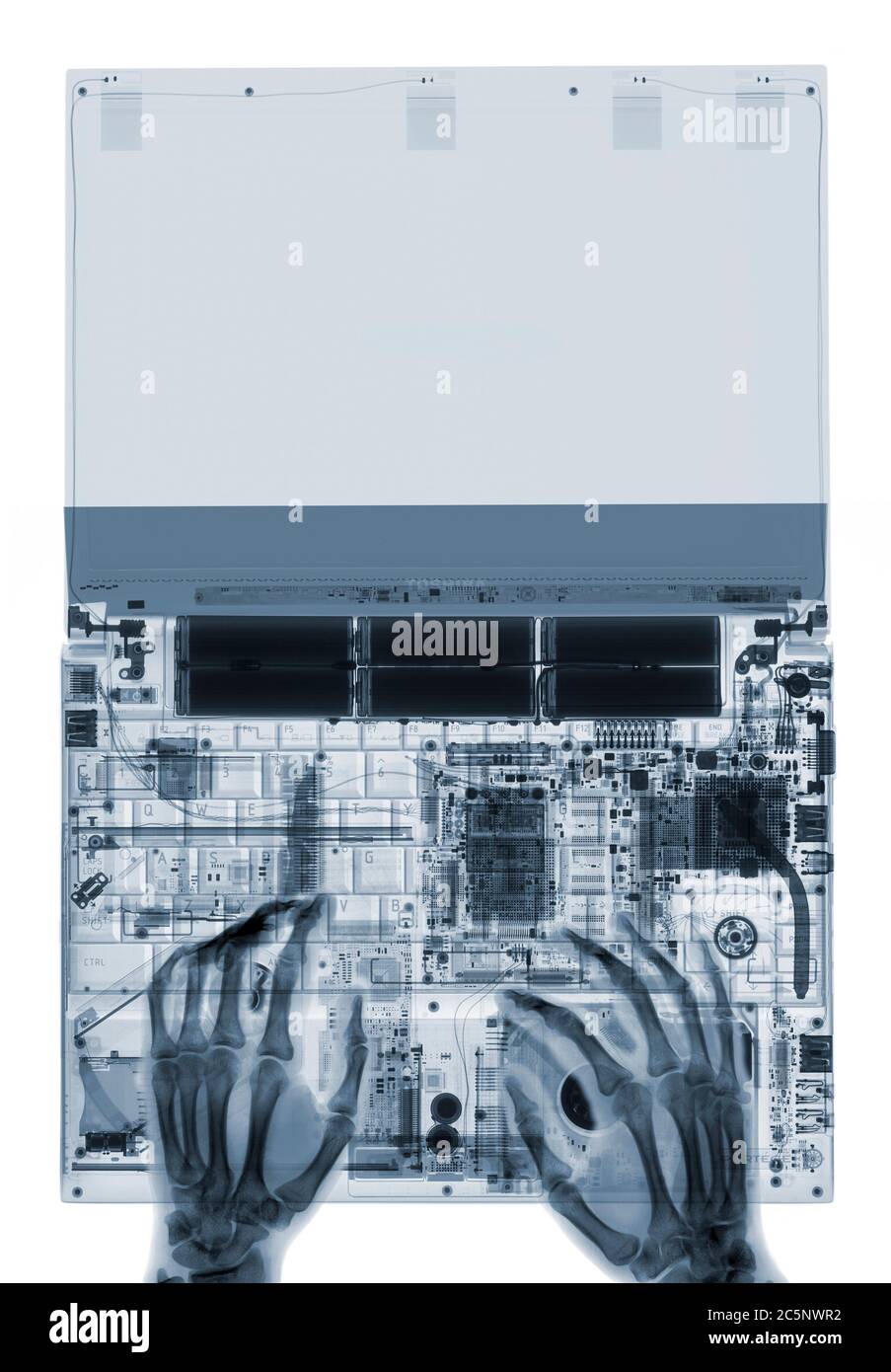 Digitazione delle mani su un computer portatile aperto, raggi X. Foto Stock