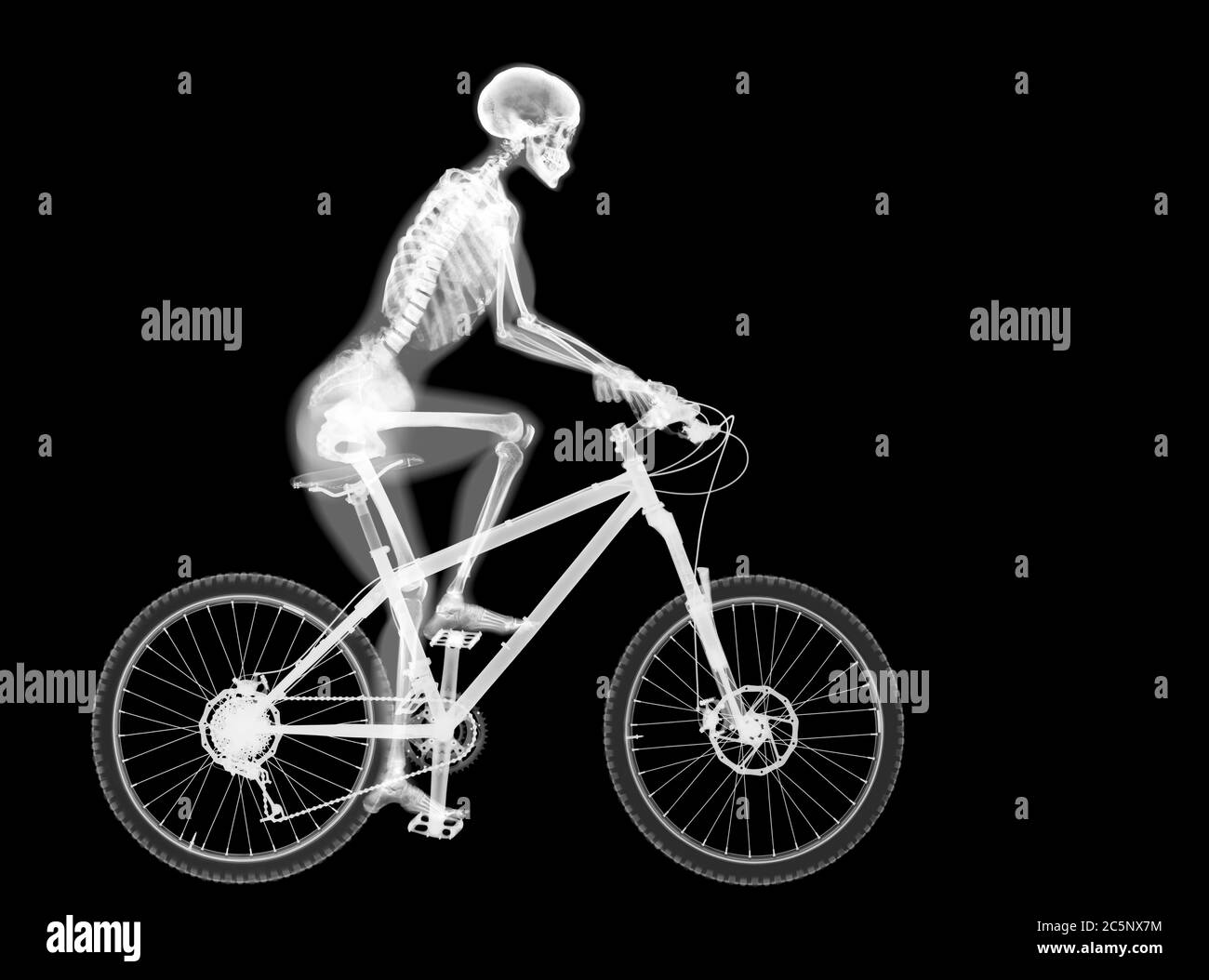 Bicicletta da montagna e scheletro, raggi X. Foto Stock