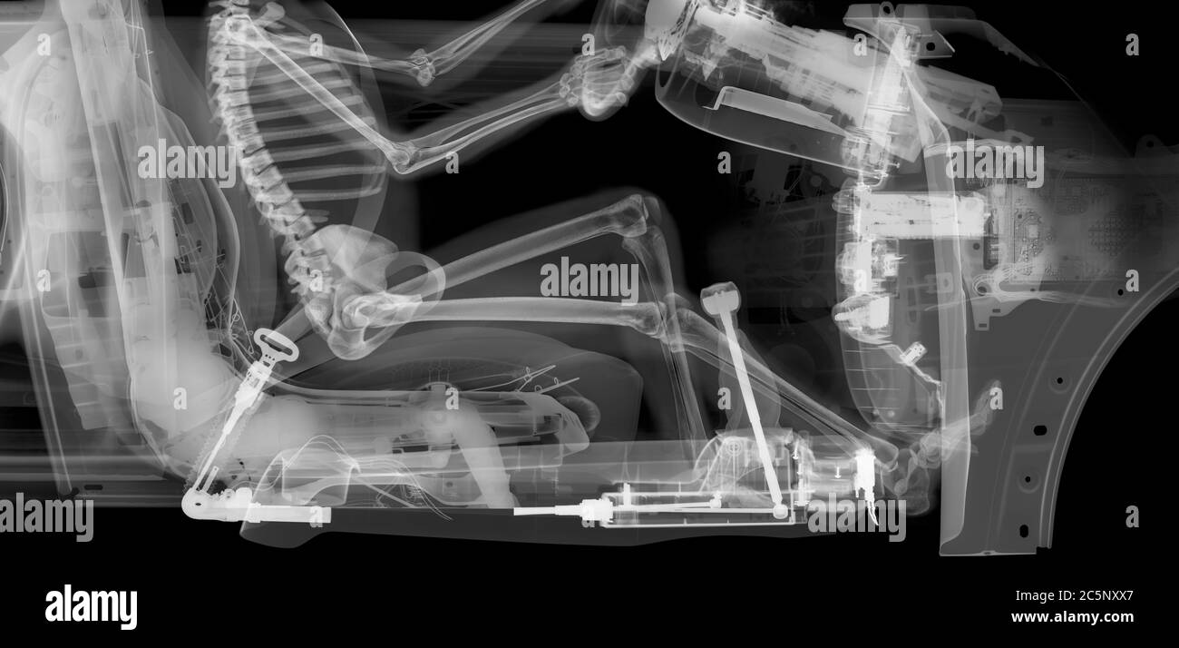 Raccolto di driver scheletro in auto, raggi X. Foto Stock