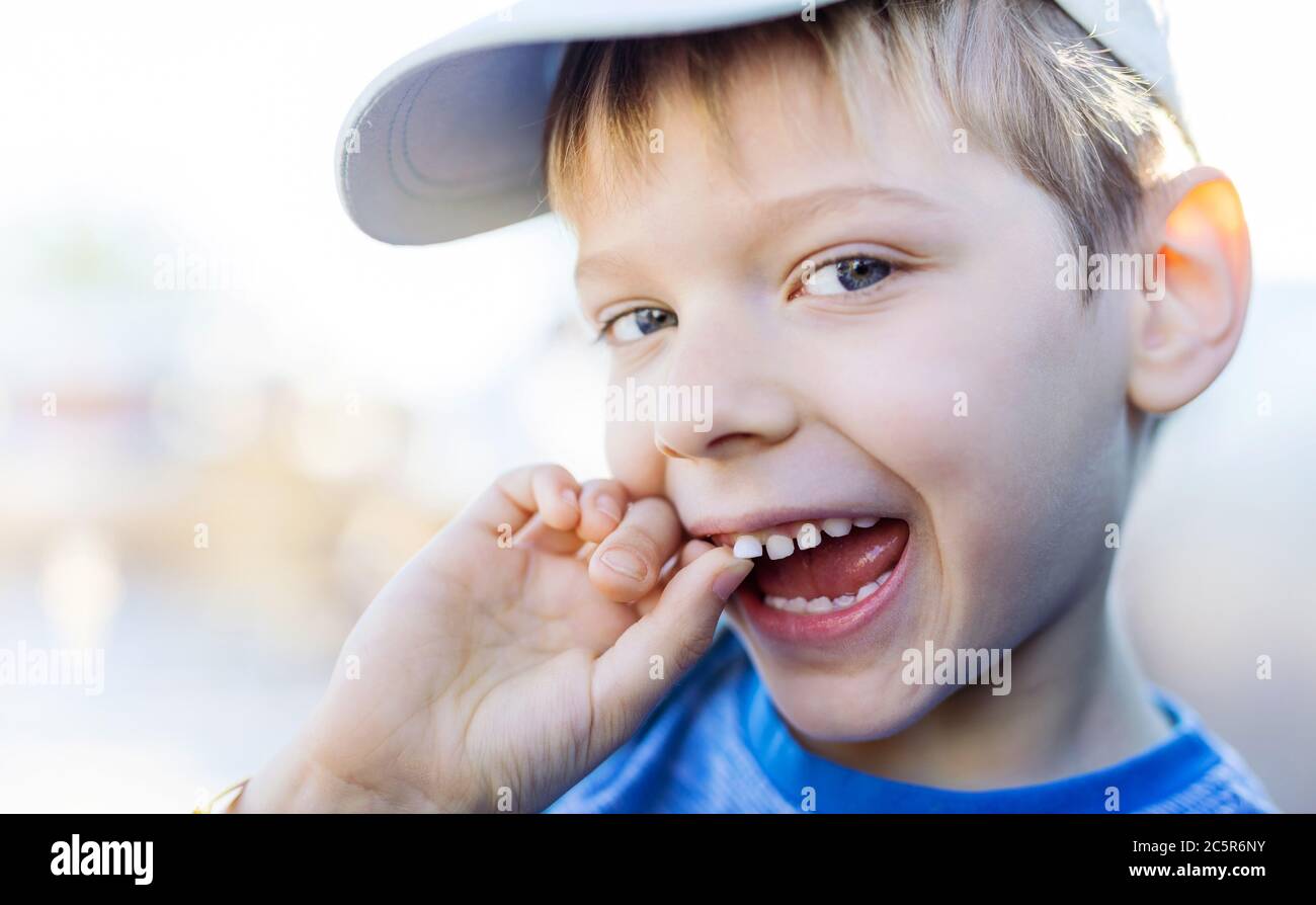 Un primo piano di un ragazzo felice che agita il suo dente di latte con le dita. Dente anteriore superiore. Concetto di igiene dentale e di sanità. Foto Stock