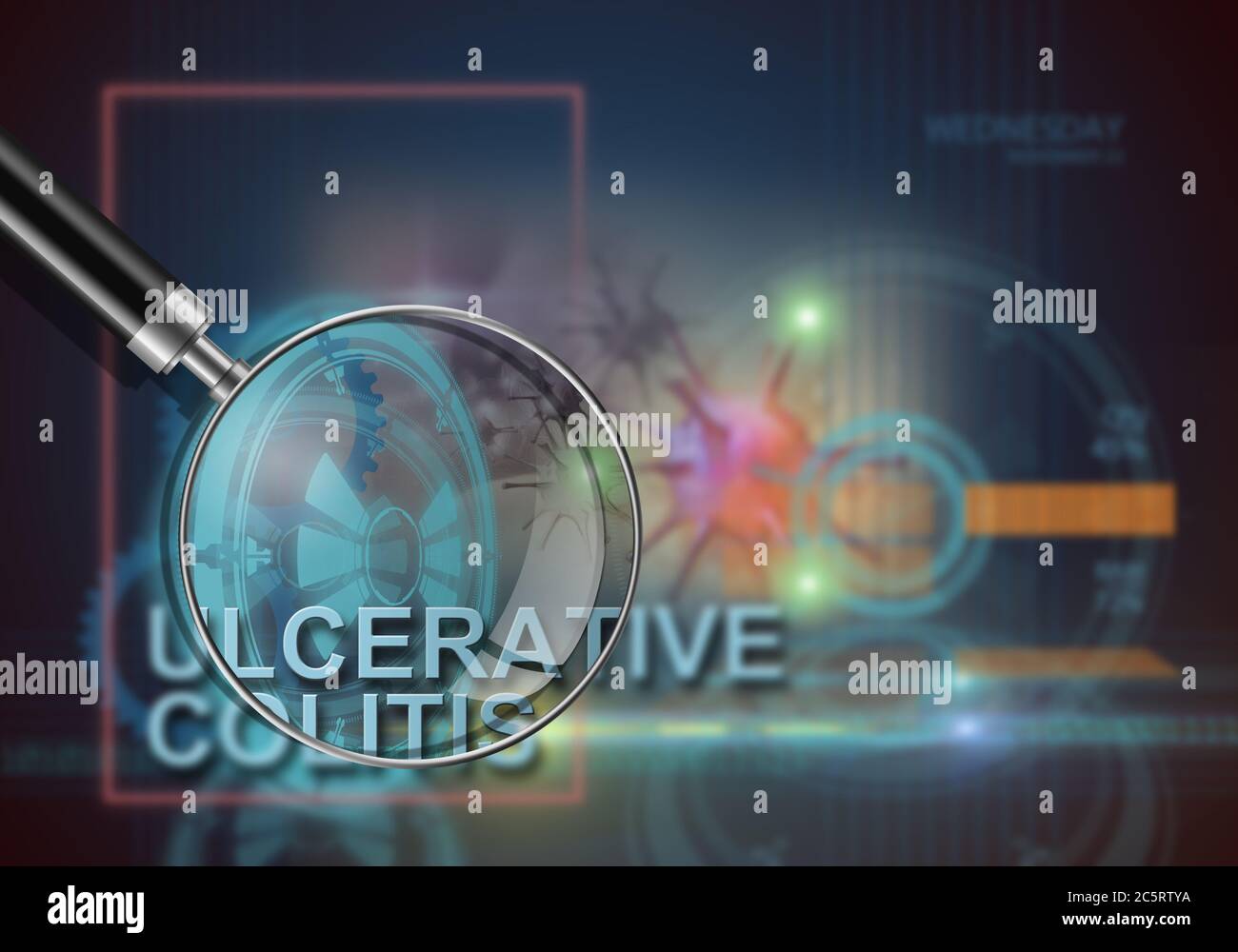 infografiche hi tech della colite ulcerosa realizzata in software 3d Foto Stock