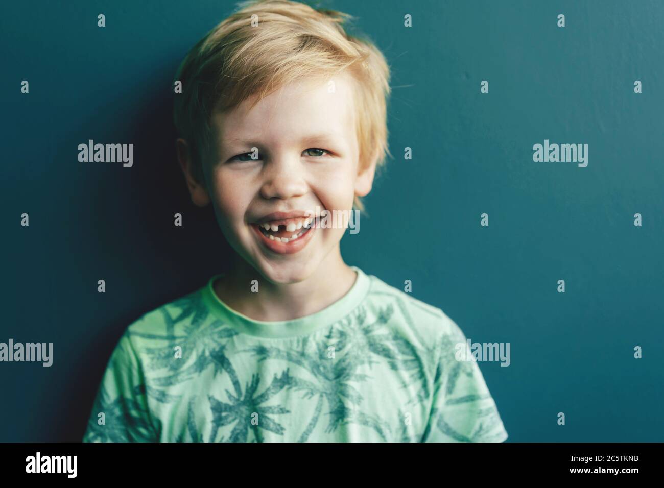 ragazzo preschooler sorridente senza denti Foto Stock