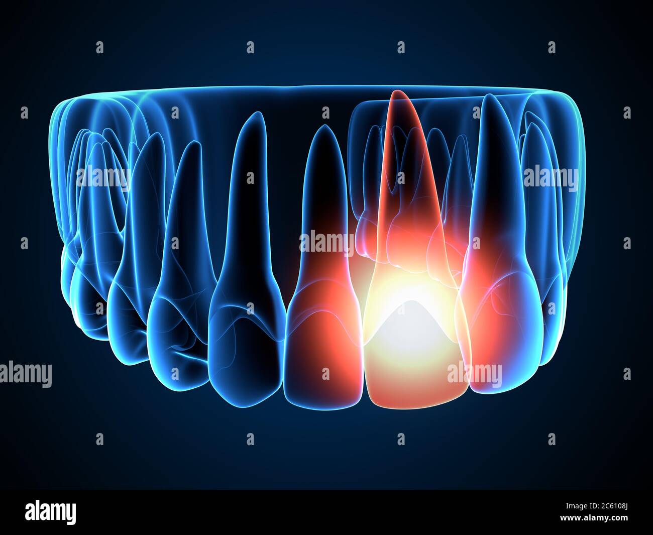 rendering 3d dei raggi x della mascella con mal di denti premolari. Foto Stock