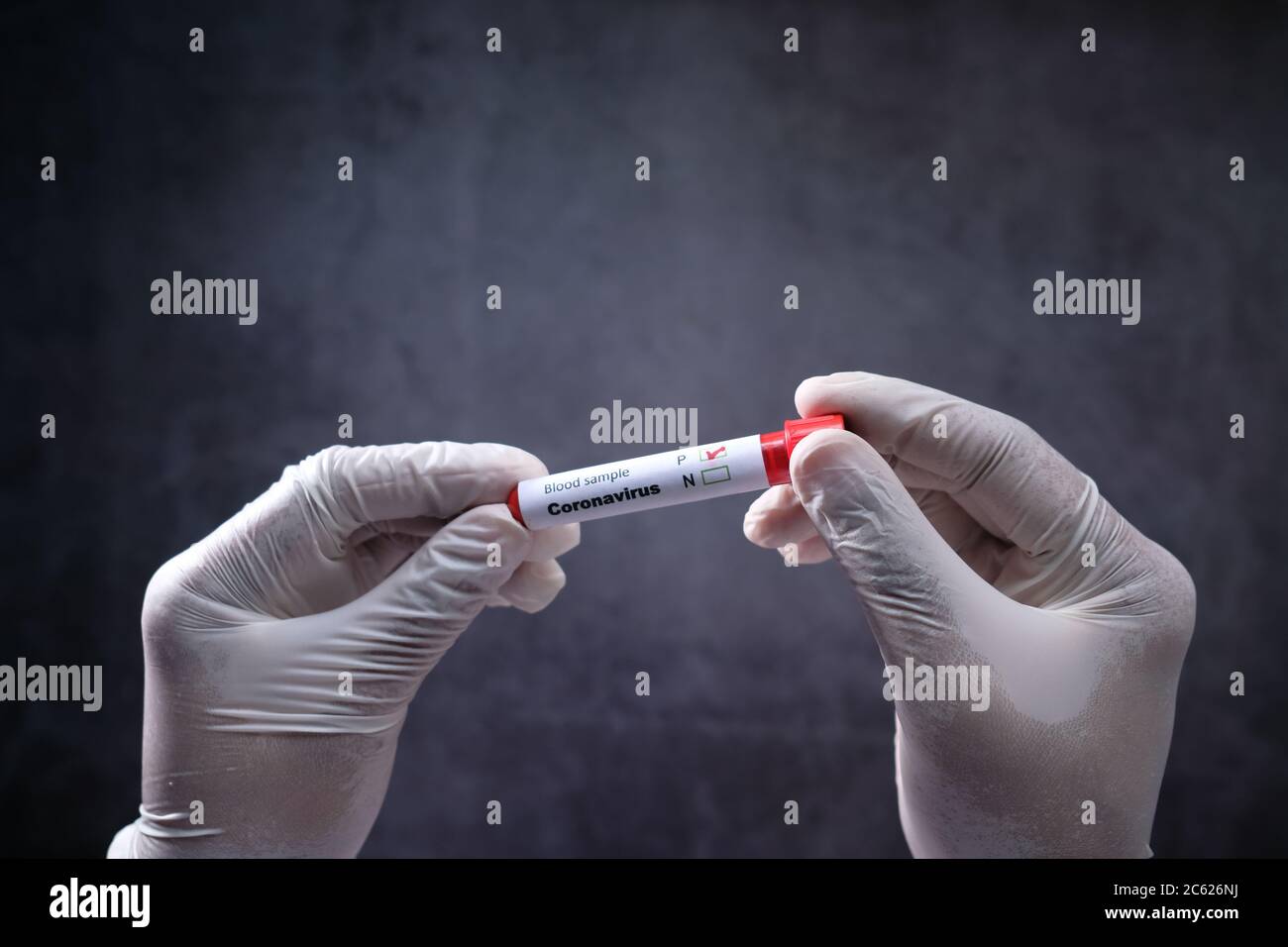 provetta per analisi del sangue con supporto manuale per il tecnico di laboratorio Foto Stock