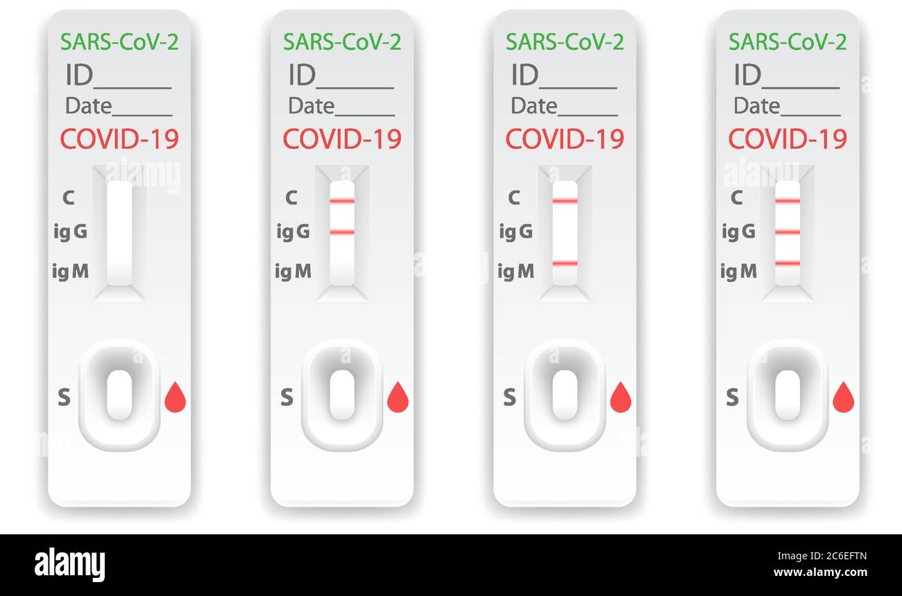 Serie di test rapidi per anticorpi al coronavirus con risultati differenti Ig M e Ig G. Presenza o assenza di virus e di materiale infettivo di Covid 19 Illustrazione Vettoriale
