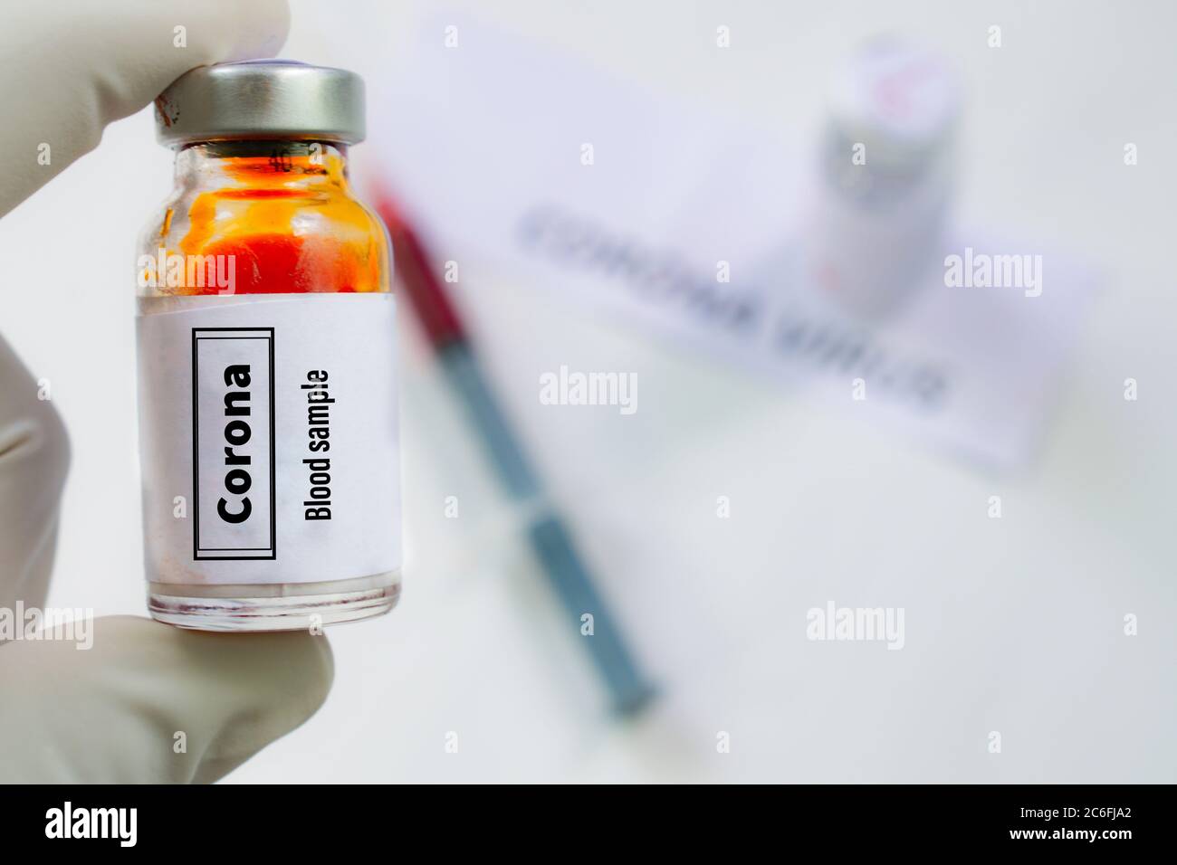Flacone contenente un campione di sangue per l'analisi della micidiale covid19 diaease. Foto Stock