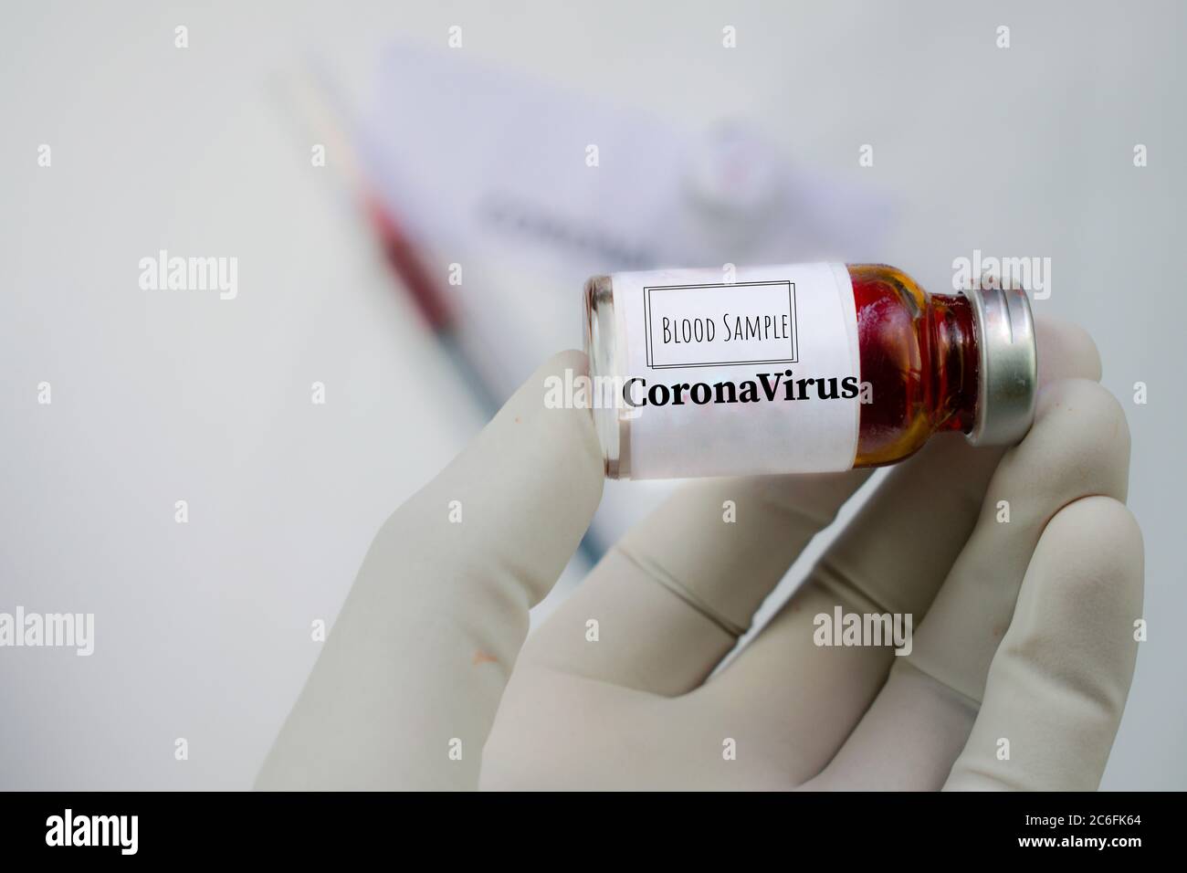 Flacone contenente un campione di sangue per l'analisi della micidiale covid19 diaease. Foto Stock