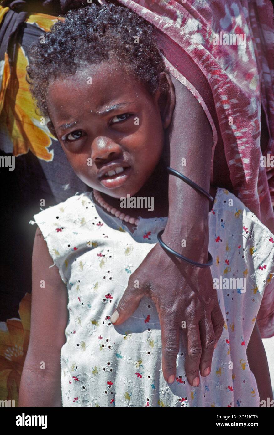 1993 - un somalo bambina guarda verso la fotocamera mentre si è in attesa di essere esaminato da un Navy corpsman. La lotta contro il supporto di servizio il distacco 15 (CSSD-15) sta conducendo un medico civica programma di azione per le strade della città durante la multinazionale soccorsi Restore Hope. Foto Stock