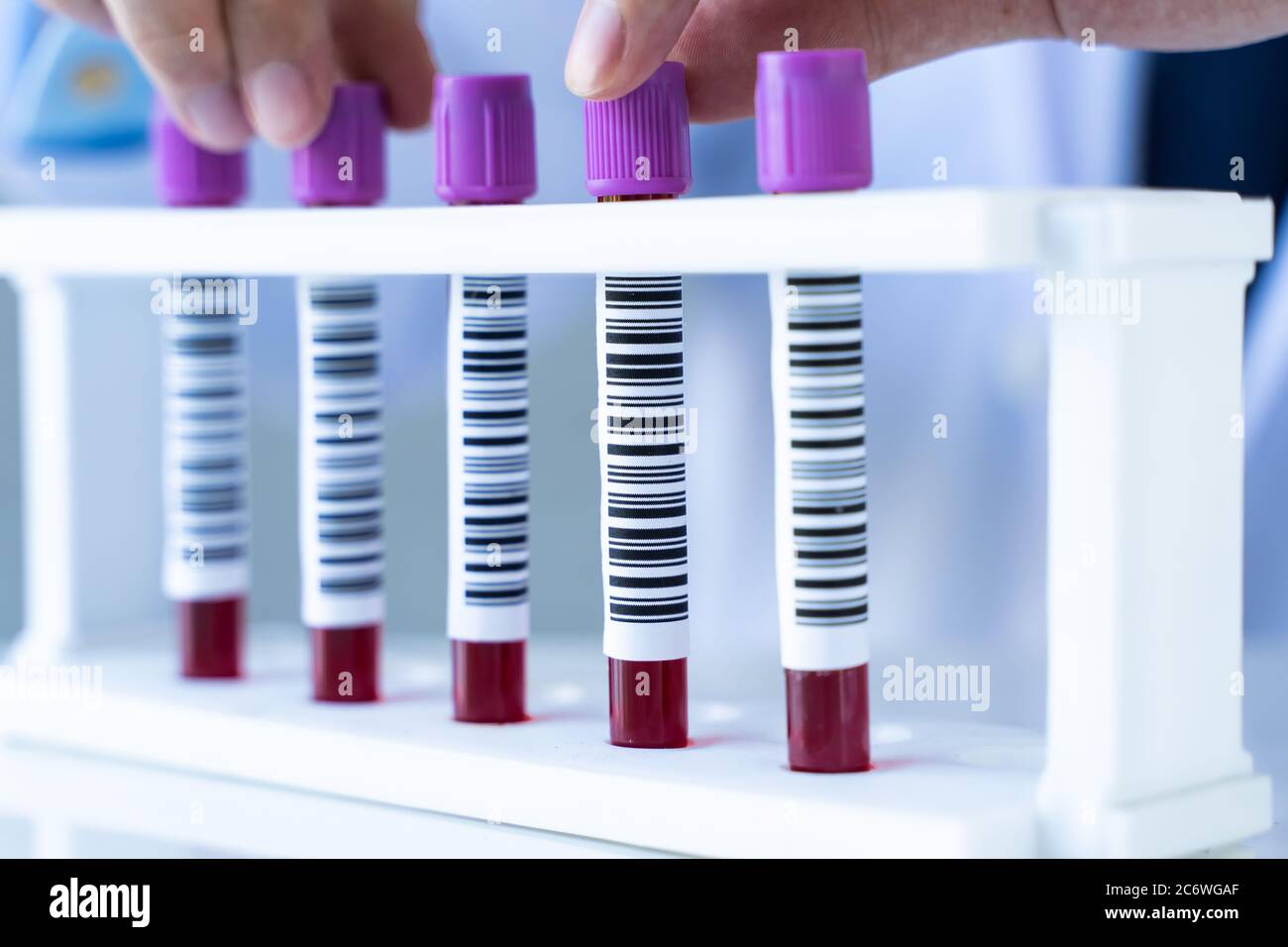 Mani di un tecnico di laboratorio con provette per analisi del sangue in fila per analisi del sangue di laboratorio. Foto Stock