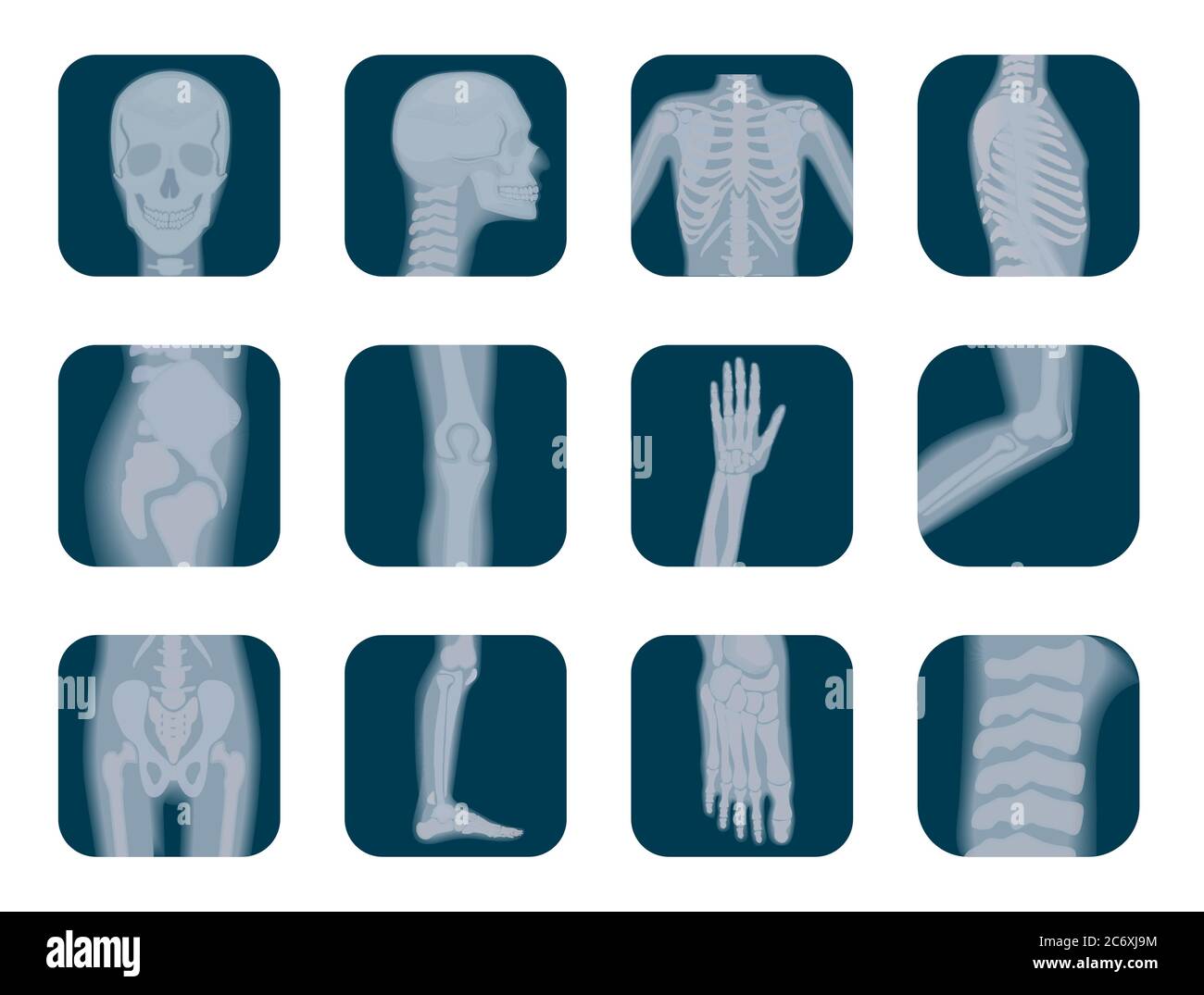 Set di icone di scheletro radiologico vettoriale realistico. Elementi a raggi X scheletrici umani. Icona parti del corpo Illustrazione Vettoriale